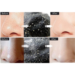 1 Peça Máscara Facial Preta Tratamentos De Acne e Pontos Pretos Pele lisinha, limpa