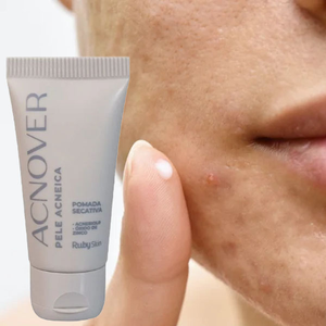 Pomada secativa acnover ruby rose 15g