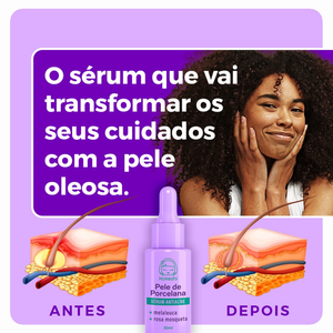 Sérum Facial Antiacne Pele de Porcelana Kokeshi Antisséptica 30ml