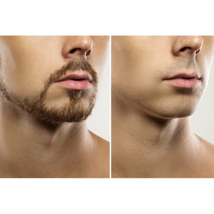 Depila Sem Dor Creme Depilação Perfeita Para Axilas Pernas Virilha Rosto e Corpo