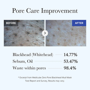 Medicube Zero Pore Black Head Mud Máscara Facial Mask Multi Funcional Limpeza E Hidratante Aplicação De Filme De Lama Rá