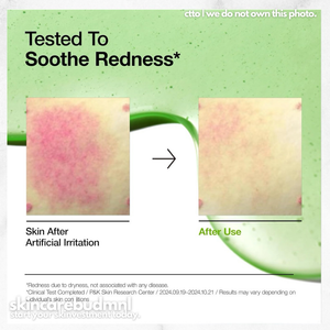 30 ml Anua Ácido Azelaico 10 Sérum Calmante de Hialuron para Vermelhidão