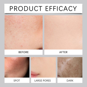 Pó Enzimático Para Lavagem Facial Em Limpador De Espuma Com Bromelaína AHA Esfolia Suavemente Desobstrui Os Poros Pele L