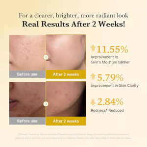 Medicube Ácido Kójico Cúrcuma Vitamina Essência 30ml Cuidados Com Manchas Escuras Iluminando O Tom Da Pele Refrescante H