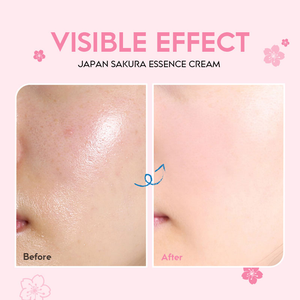 LAIKOU Japão Sakura Essence Creme Iluminador Antienvelhecimento Hidratante Rejuvenescedor Da Pele 60g