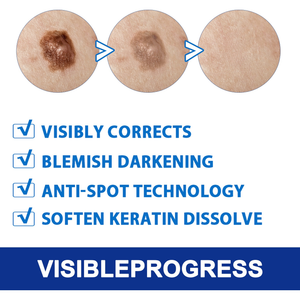 EELHOE Pele Clara e Lisa, Cascas para Mãos e Pés, Verrugas Filamentosas, Olhos Afiados, Limpeza Suave da Pele, Creme Ke