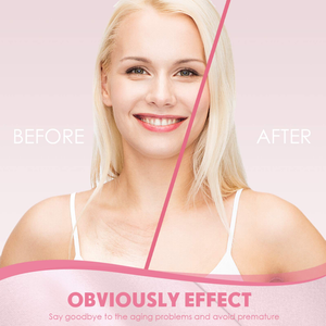 Almofadas de Silicone em Forma de T para Colarinho Recicláveis Suavizam Sua Pele e Previne o Envelhecimento da Pele