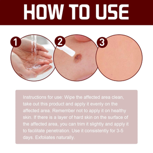 Pomada Caneta para Verrugas Ke Warts, Removedor de Mole Preto, Reparação da Pele, Clareamento, Cuidado Hidratante, 3ml