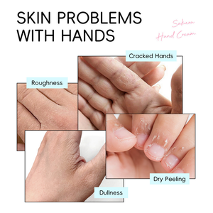 LAIKOU Japão Sakura Creme Para As Mãos Reparador Ro ugh Clareamento Nutritivo A Pele 30g