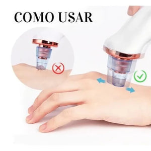 Removedor De Cravos Espinhas Cleaning Sugador Poros Acne Sucção Usb Recarregável