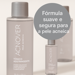 Acnover Antiacne Loção Tônica - 120ml - Ruby Rose