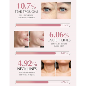 Bastão Multibálsamo KAHI Wrinkle Bounce | De Rugas De Colágeno PDRN Cuidados Com A Pele Coreanos Bálsamo Labial Hidratan