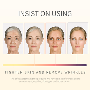 LAIKOU Vitamina C Creme Facial Remover Manchas De Sardas VC Iluminador Beleza 25g