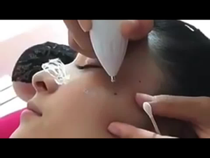 Caneta De Plasma Lcd De Nove Níveis : Iluminação Led Para Cuidados Faciais , Limpeza Da Pele Com Efeito De Luz Branca E