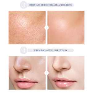 24K Ouro Niacinamida Essência Facial Hidratante Anti Idade E Rugas Sérum Ácido Hialurônico Encolhimentos Poros Reparos Pele Seca Solta