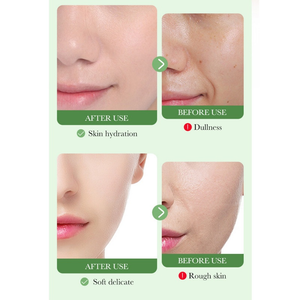 BIOAOUA Centella Asiatica Soro Facial Suavizante Com Hidratação Hidratante E Efeitos Calmantes 30ml