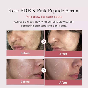 Medicube PDRN Pink Peptide Serum, Niacinamide, Hydrating, Korean Skincare