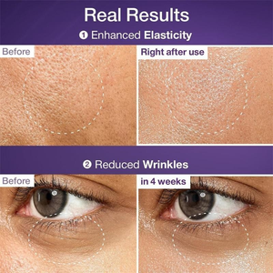 Soro numbuzin No . 9 | Lifting NAD + BIO , Reafirmante , Rugas , Linhas Finas , Elasticidade Antienvelhecimento , Para P