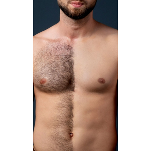 Depila Sem Dor Creme Depilação Perfeita Para Axilas Pernas Virilha Rosto e Corpo