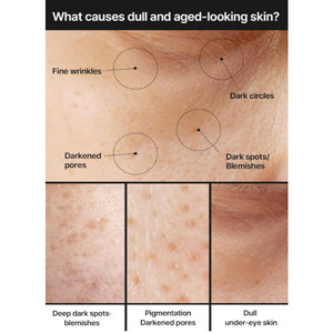 celimax PORE + Creme Iluminador De Manchas Escuras (7ml , 35ml)