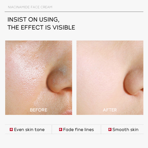 LAIKOU PRO Niacinamida Creme Brilhante Pele Nutritiva Melhora A Elasticidade 30g