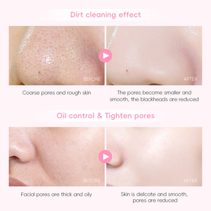 Máscara De Lama De Limpeza LAIKOU Sakura 25g/0.88 Onças . Rejuvenescimento Da Pele Com Controle De Óleo Suave