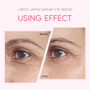 LAIKOU Japão Sakura Eye Serum Remove Bag Essência Fad e Rugas Anti-Inchaço 15ml